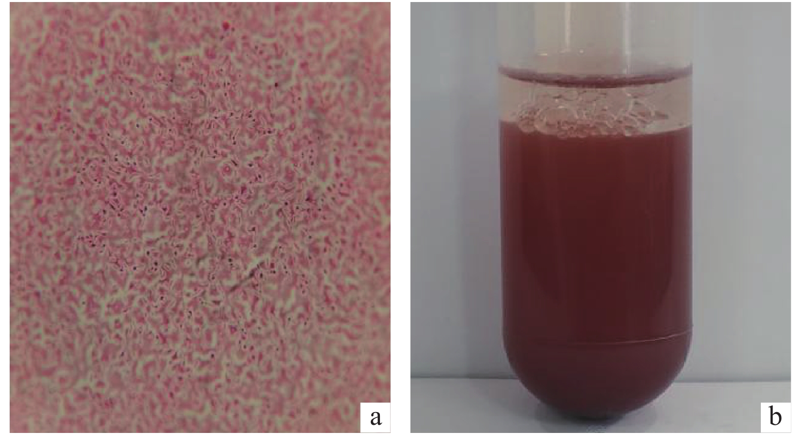 图                     菌株p-3鞭毛染色  (a